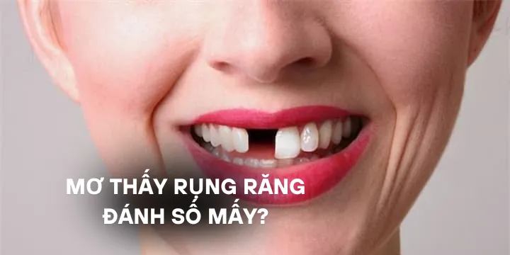 Mơ thấy rụng răng đánh số mấy là chính xác và dễ trúng?